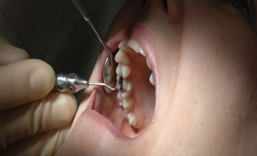 Clínica é condenada por causar dores em pacientes após implantes dentários