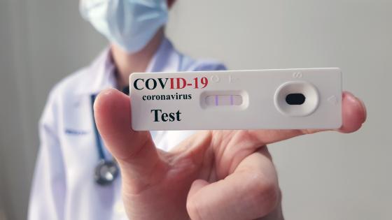 Foram notificados apenas 24 testes positivos de Covid-19 neste domingo