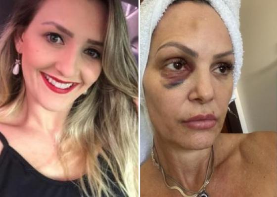 Daiane Tonetta Neitzke, 26 anos, e Débora Sander, 43, tiveram relação conturbada com policial Sanderson Castro