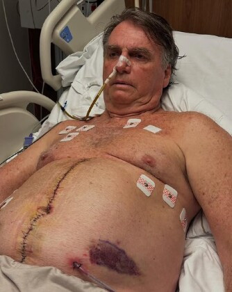 BOLSONARO HOSPITAL