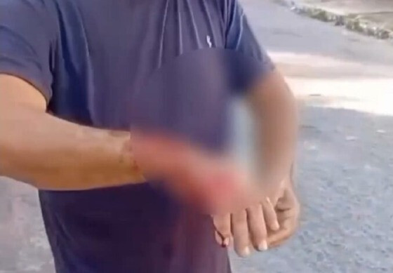 Pitbull ataca homem e mata cadedla 