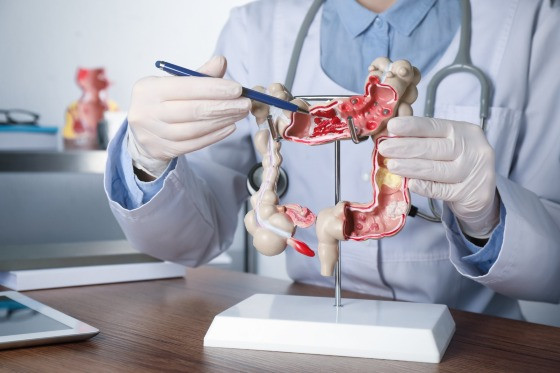 Diagnóstico precoce é essencial para salvar vidas, alerta oncologista