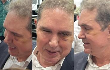 Vice-prefeito aparece com hematomas após procedimentos estéticos
